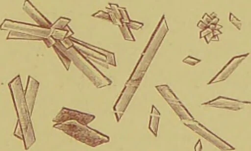 An illustration from Clinical diagnosis : the bacteriological, chemical, and microscopical evidence of disease / By Dr. Rudolf v. Jaksch, ... Translated from the third German edition and enlarged by James Cagney, ... With numerous illustrations (partly in colours)., 1893, leaf 89