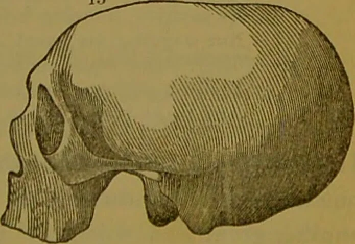 An illustration from Elements of phrenology / By George Combe., 1841, leaf 105