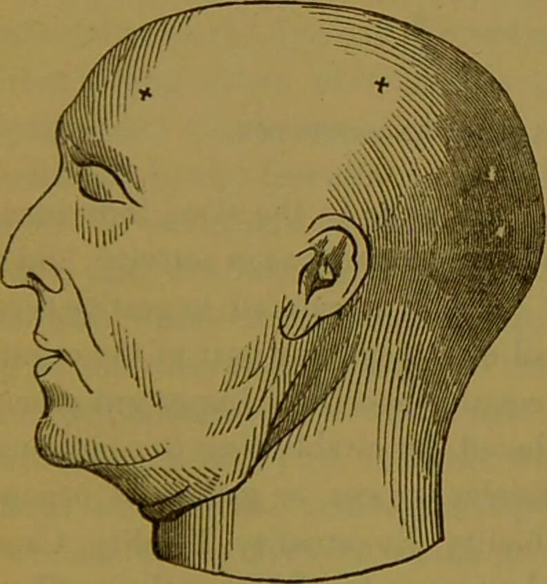 An illustration from Elements of phrenology / By George Combe., 1841, leaf 189