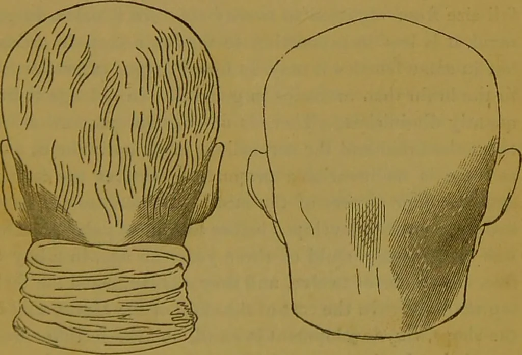 An illustration from Elements of phrenology / By George Combe., 1841, leaf 77