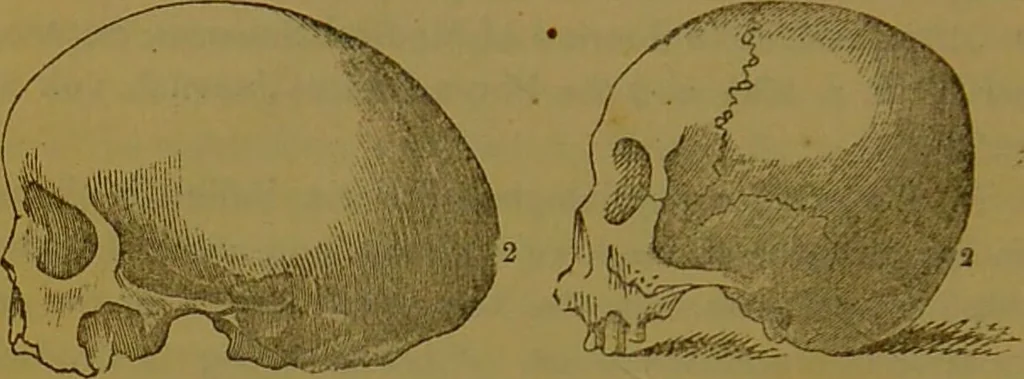 An illustration from Elements of phrenology / By George Combe., 1841, leaf 80