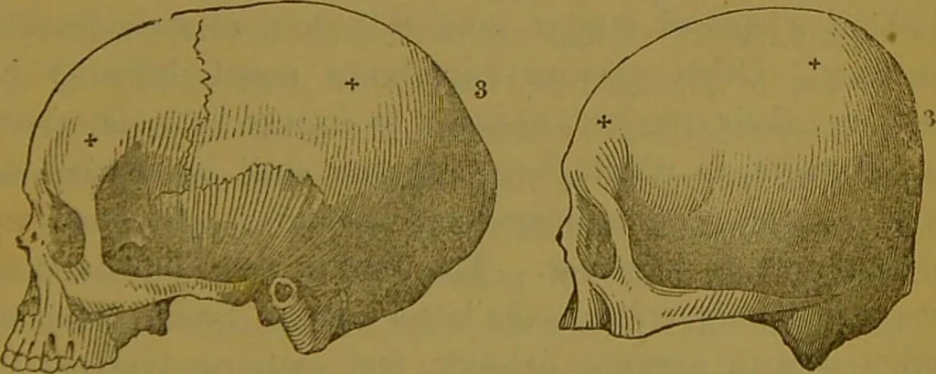 An illustration from Elements of phrenology / By George Combe., 1841, leaf 81