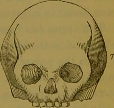 An illustration from Elements of phrenology / By George Combe., 1841, leaf 91