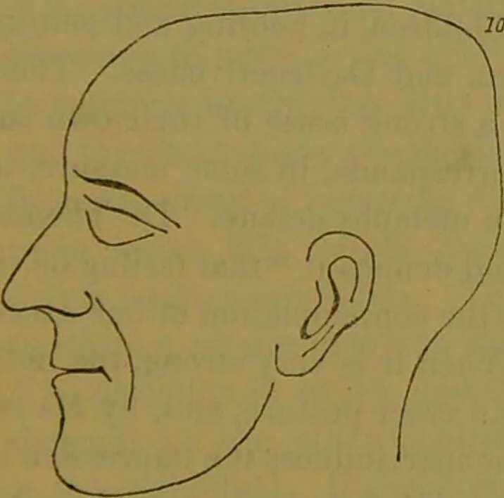 An illustration from Elements of phrenology / By George Combe., 1841, leaf 99