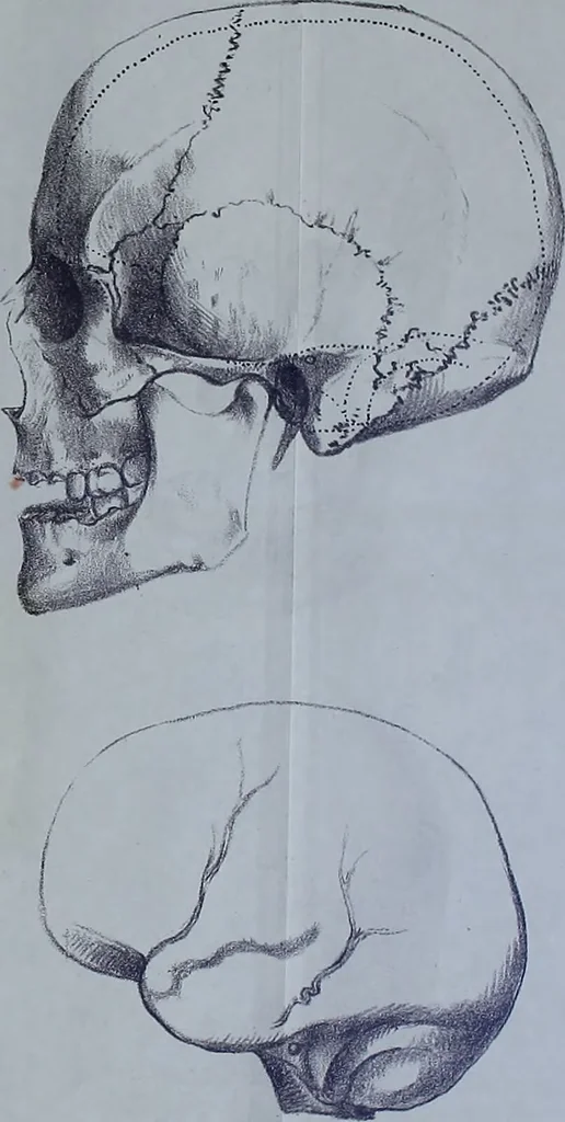 An illustration from Beitraege zur Craniologie / von Th. Landzert., 1867, leaf 59