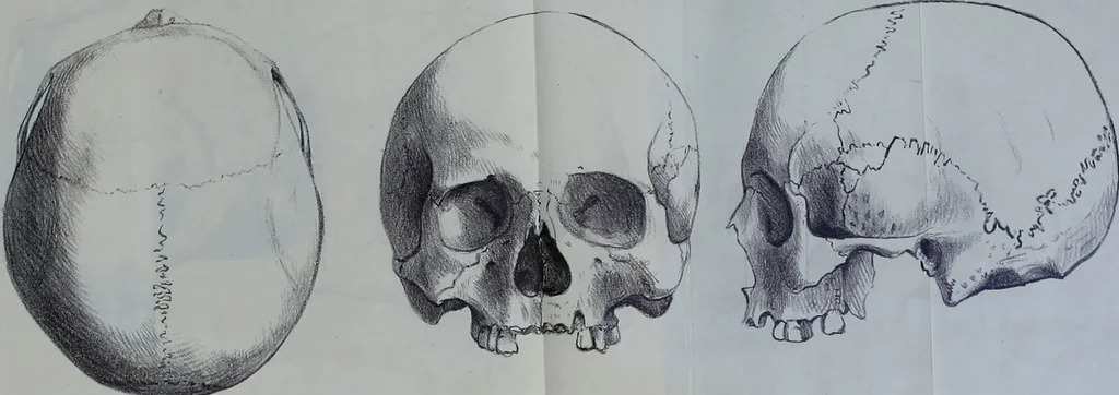 An illustration from Beitraege zur Craniologie / von Th. Landzert., 1867, leaf 61