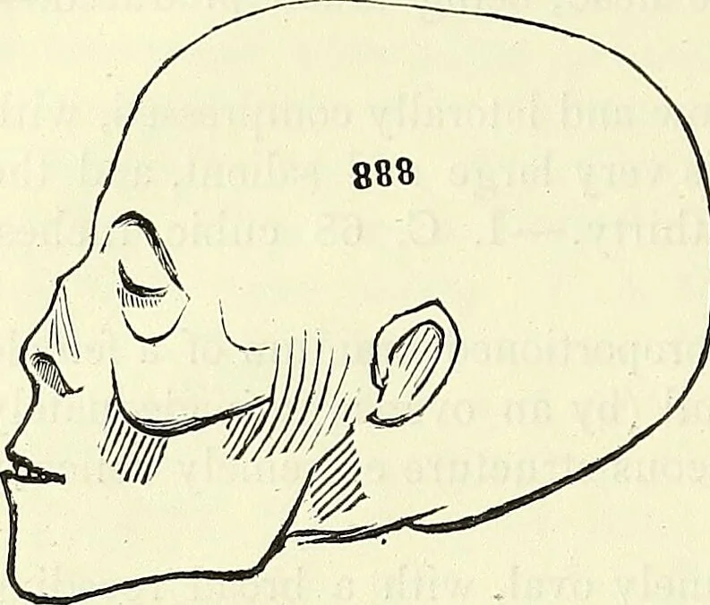 An illustration from Crania Aegyptiaca, or, Observations on Egyptian ethnography derived from anatomy, history and the monuments / by Samuel George Morton., 1844, leaf 22