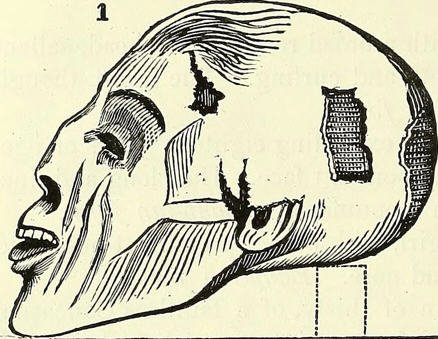 An illustration from Crania Aegyptiaca, or, Observations on Egyptian ethnography derived from anatomy, history and the monuments / by Samuel George Morton., 1844, leaf 24