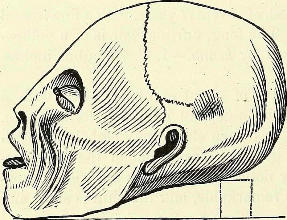 An illustration from Crania Aegyptiaca, or, Observations on Egyptian ethnography derived from anatomy, history and the monuments / by Samuel George Morton., 1844, leaf 24