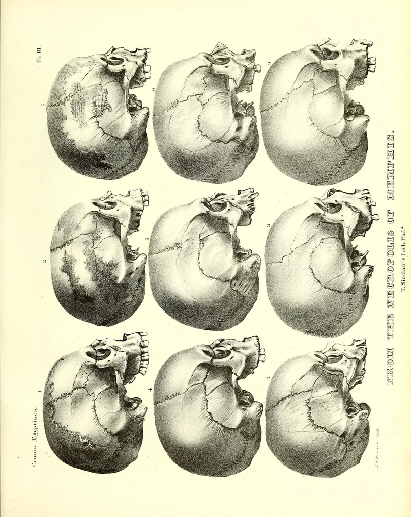 An illustration from Crania Aegyptiaca, or, Observations on Egyptian ethnography derived from anatomy, history and the monuments / by Samuel George Morton., 1844, leaf 83