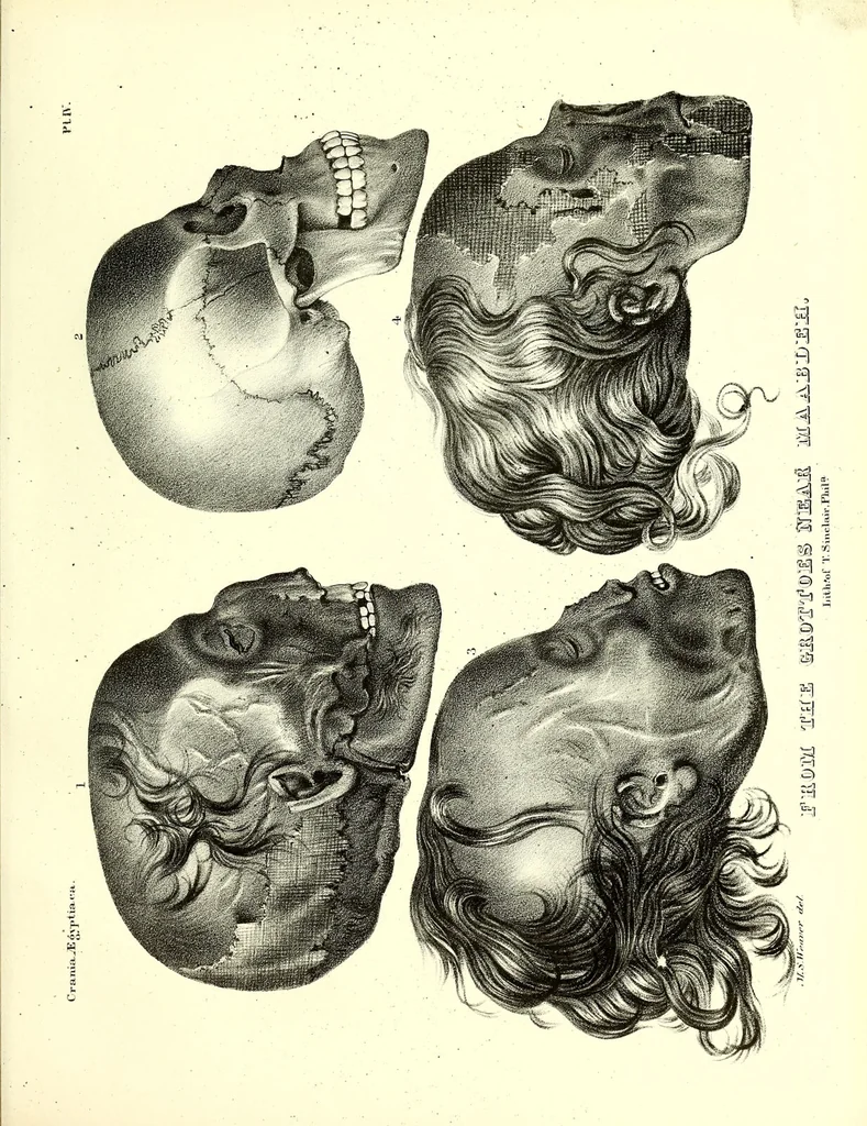 An illustration from Crania Aegyptiaca, or, Observations on Egyptian ethnography derived from anatomy, history and the monuments / by Samuel George Morton., 1844, leaf 85