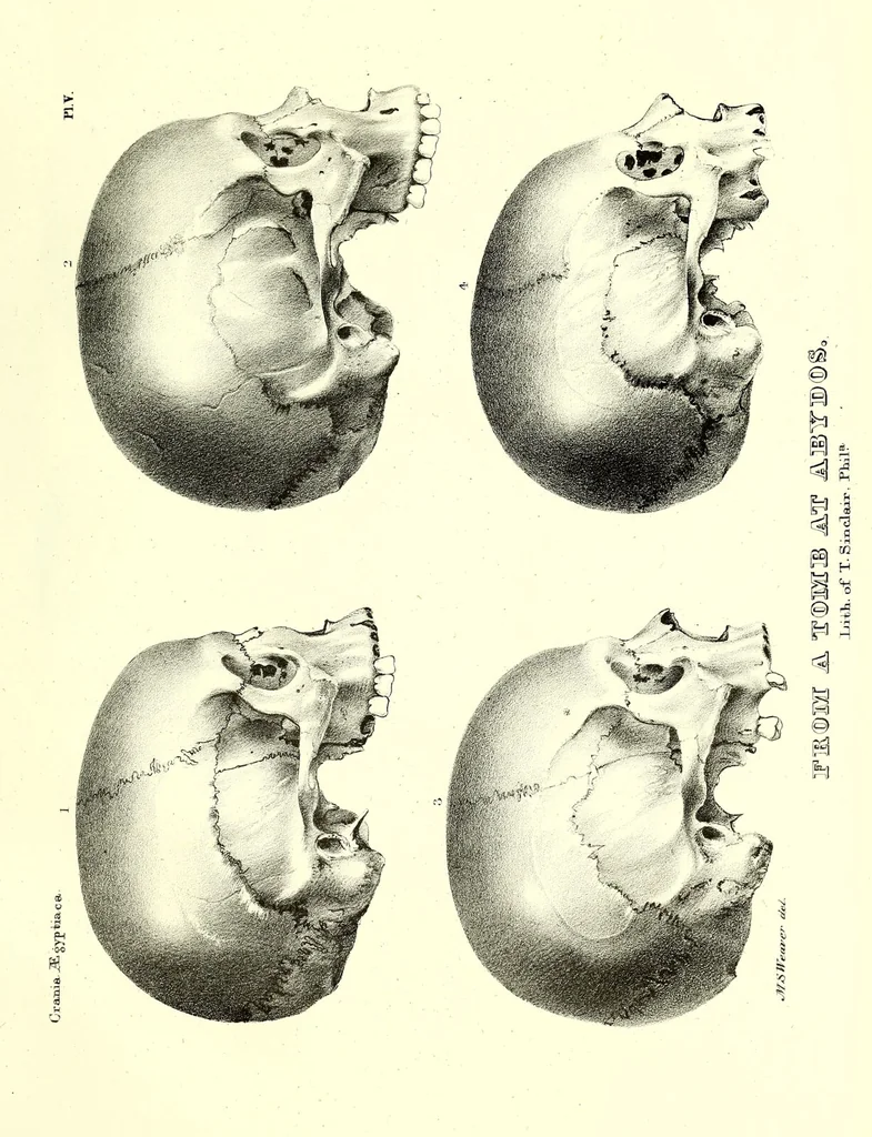 An illustration from Crania Aegyptiaca, or, Observations on Egyptian ethnography derived from anatomy, history and the monuments / by Samuel George Morton., 1844, leaf 87