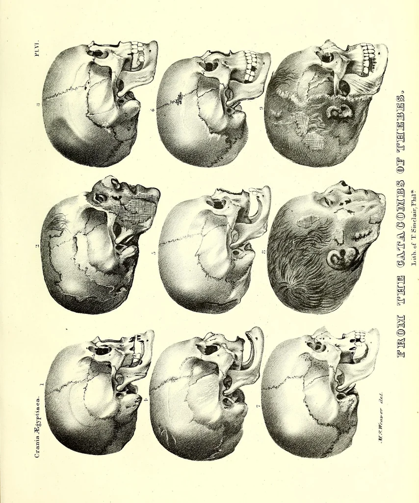 An illustration from Crania Aegyptiaca, or, Observations on Egyptian ethnography derived from anatomy, history and the monuments / by Samuel George Morton., 1844, leaf 89