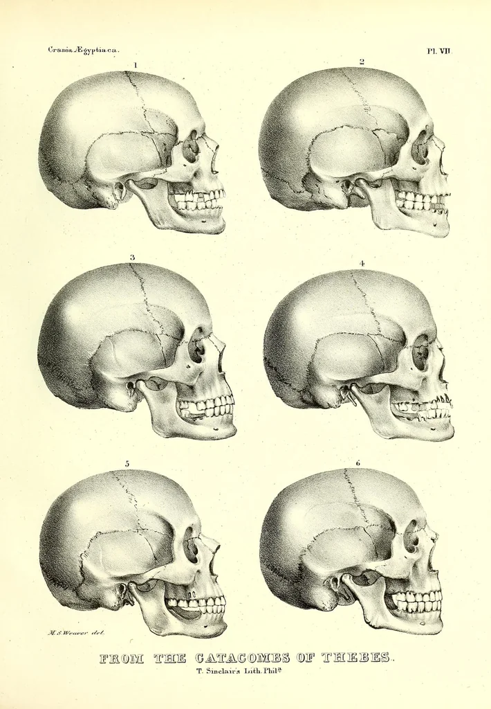An illustration from Crania Aegyptiaca, or, Observations on Egyptian ethnography derived from anatomy, history and the monuments / by Samuel George Morton., 1844, leaf 91