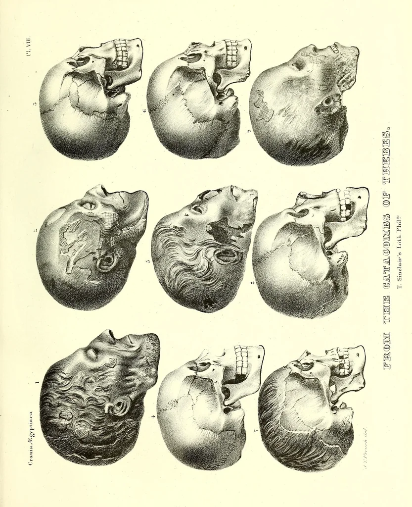 An illustration from Crania Aegyptiaca, or, Observations on Egyptian ethnography derived from anatomy, history and the monuments / by Samuel George Morton., 1844, leaf 93