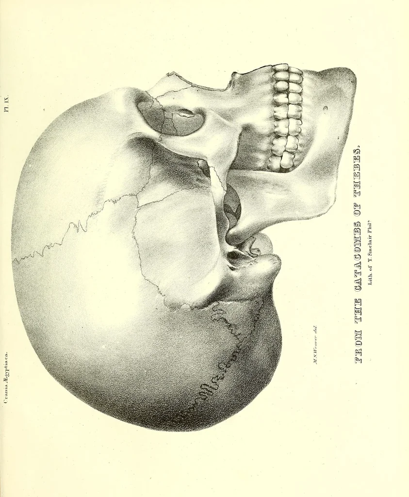 An illustration from Crania Aegyptiaca, or, Observations on Egyptian ethnography derived from anatomy, history and the monuments / by Samuel George Morton., 1844, leaf 95