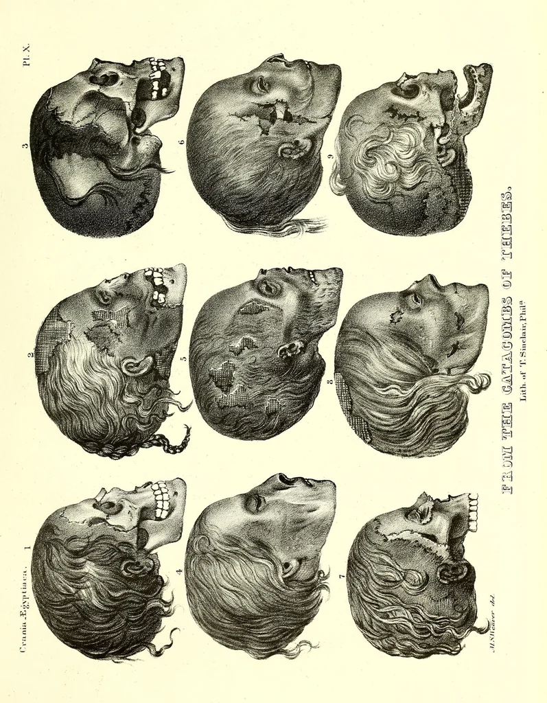 An illustration from Crania Aegyptiaca, or, Observations on Egyptian ethnography derived from anatomy, history and the monuments / by Samuel George Morton., 1844, leaf 97
