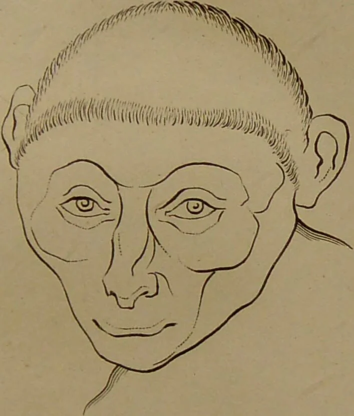 An illustration from Essays on physiognomy : designed to promote the knowledge and the love of mankind ... To which are added , one hundred physiognomonical rules, ... and memoirs of the life of the author / written by John Caspar Lavater., 1797, leaf 399