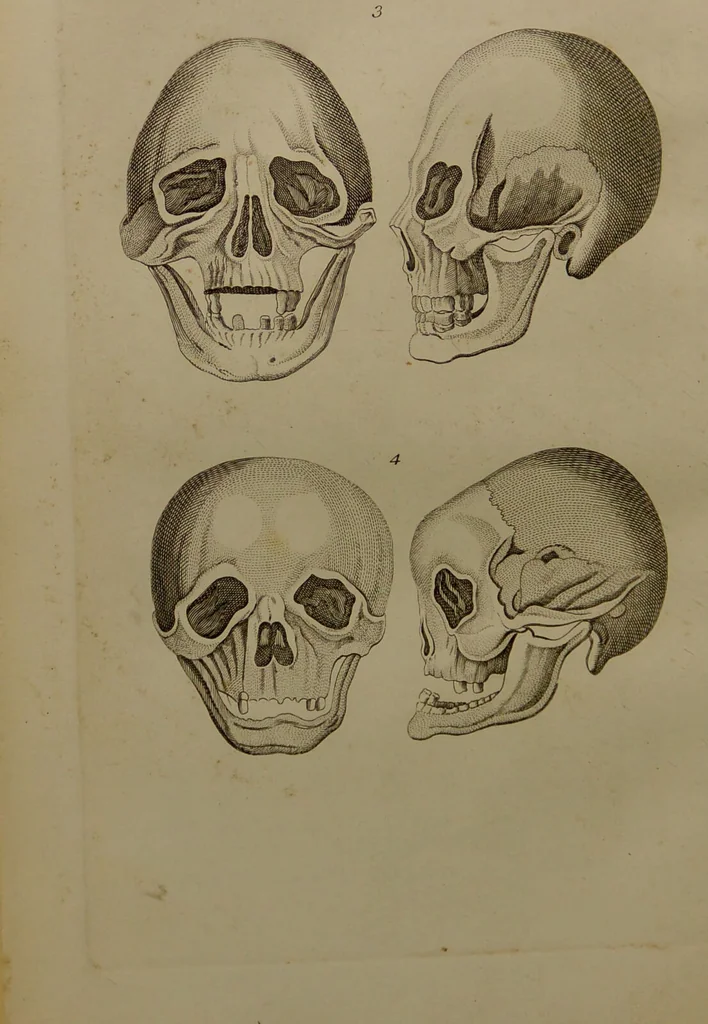 An illustration from Essays on physiognomy : designed to promote the knowledge and the love of mankind ... To which are added , one hundred physiognomonical rules, ... and memoirs of the life of the author / written by John Caspar Lavater., 1797, leaf 458