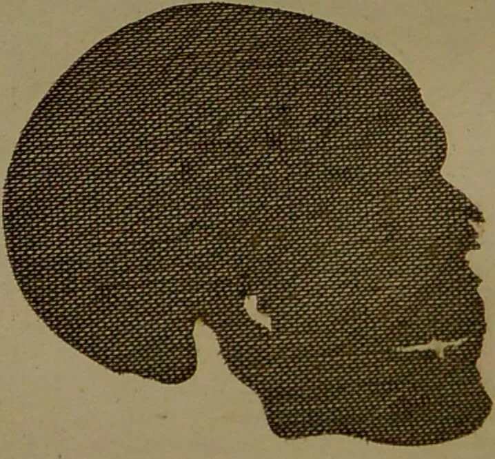 An illustration from Essays on physiognomy : designed to promote the knowledge and the love of mankind ... To which are added , one hundred physiognomonical rules, ... and memoirs of the life of the author / written by John Caspar Lavater., 1797, leaf 476