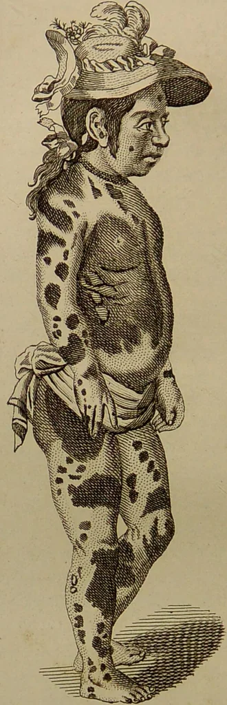 An illustration from Essays on physiognomy : designed to promote the knowledge and the love of mankind ... To which are added , one hundred physiognomonical rules, ... and memoirs of the life of the author / written by John Caspar Lavater., 1797, leaf 684