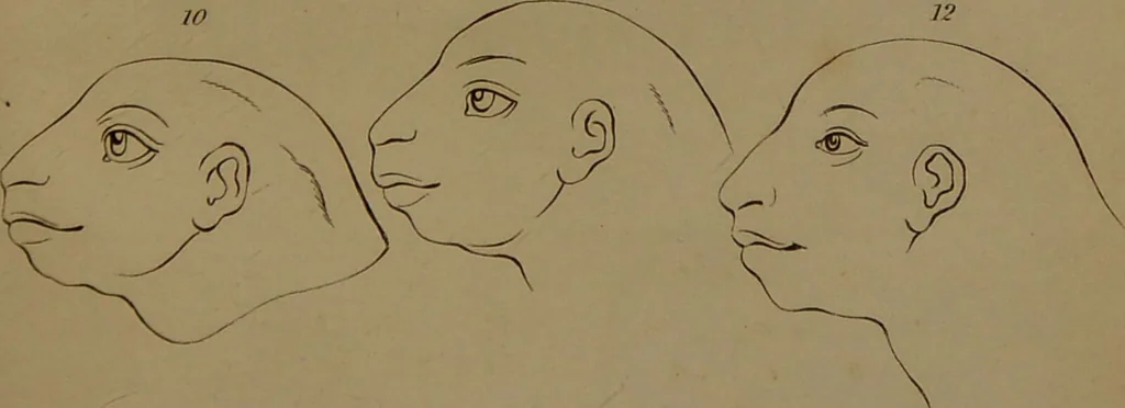 An illustration from Essays on physiognomy : designed to promote the knowledge and the love of mankind ... To which are added , one hundred physiognomonical rules, ... and memoirs of the life of the author / written by John Caspar Lavater., 1797, leaf 785