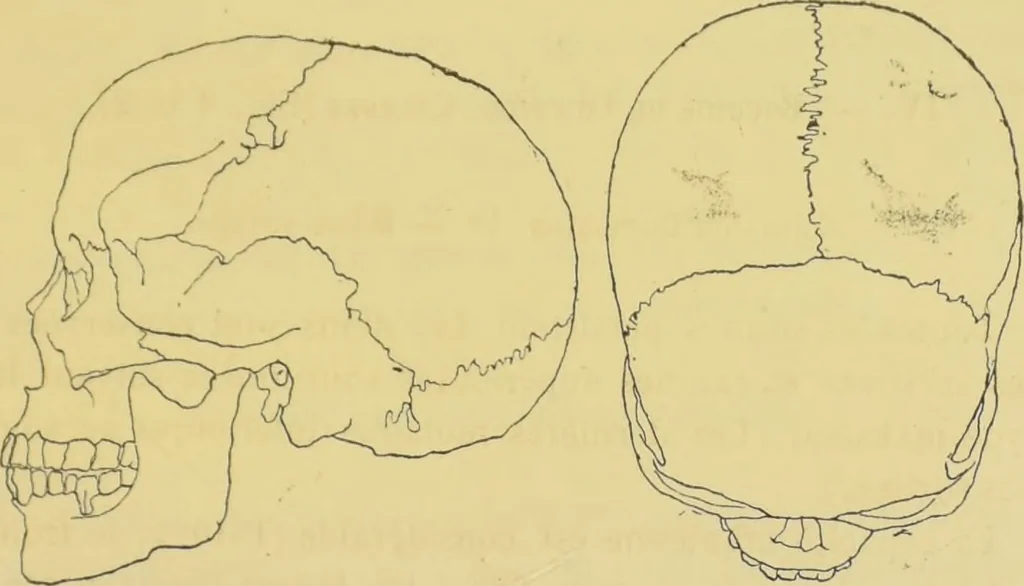 An illustration from Etude sur les cranes Boughis et Dayaks du Muséums d'histoire du naturelle / par le Dr. Montano., 1878, leaf 23