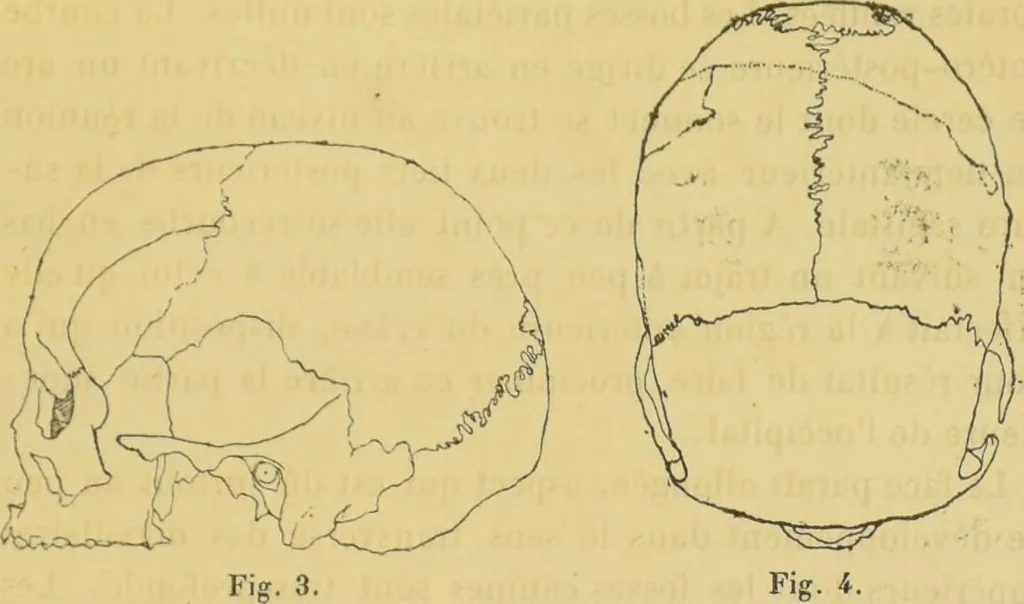 An illustration from Etude sur les cranes Boughis et Dayaks du Muséums d'histoire du naturelle / par le Dr. Montano., 1878, leaf 57