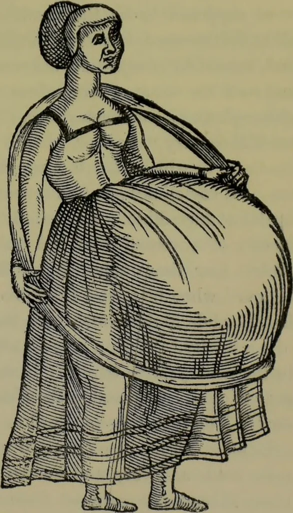 An illustration from Anomalies and curiosities of medicine : being an encyclopedic collection of rare and extraordinary cases, and of the most striking instances of abnormality in all branches of medicine and surgery, derived from an exhaustive research of medical literature from its origin to the present day / abstracted, classified, annotated, and indexed, by George M. Gould and Walter L. Pyle ; with 295 illustrations in the text, and 12 half-tone and colored plates., 1897, leaf 159