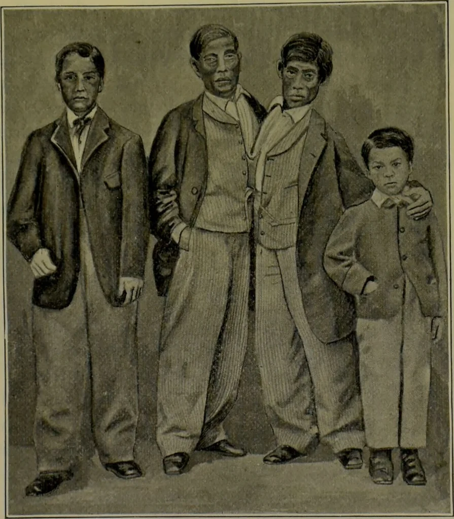 An illustration from Anomalies and curiosities of medicine : being an encyclopedic collection of rare and extraordinary cases, and of the most striking instances of abnormality in all branches of medicine and surgery, derived from an exhaustive research of medical literature from its origin to the present day / abstracted, classified, annotated, and indexed, by George M. Gould and Walter L. Pyle ; with 295 illustrations in the text, and 12 half-tone and colored plates., 1897, leaf 175