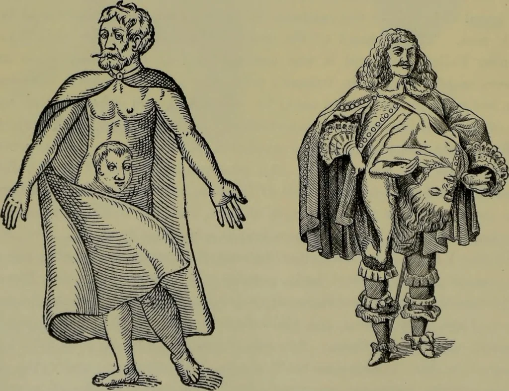 An illustration from Anomalies and curiosities of medicine : being an encyclopedic collection of rare and extraordinary cases, and of the most striking instances of abnormality in all branches of medicine and surgery, derived from an exhaustive research of medical literature from its origin to the present day / abstracted, classified, annotated, and indexed, by George M. Gould and Walter L. Pyle ; with 295 illustrations in the text, and 12 half-tone and colored plates., 1897, leaf 196