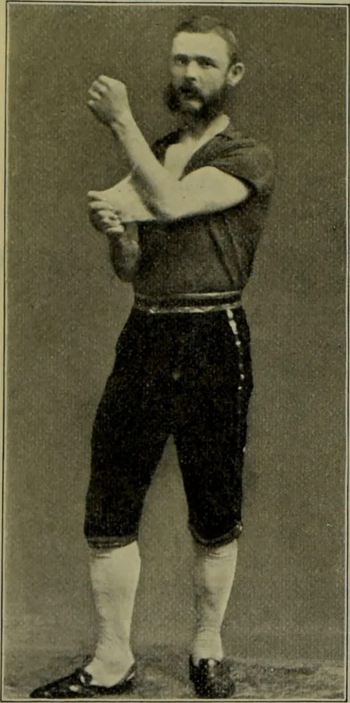 An illustration from Anomalies and curiosities of medicine : being an encyclopedic collection of rare and extraordinary cases, and of the most striking instances of abnormality in all branches of medicine and surgery, derived from an exhaustive research of medical literature from its origin to the present day / abstracted, classified, annotated, and indexed, by George M. Gould and Walter L. Pyle ; with 295 illustrations in the text, and 12 half-tone and colored plates., 1897, leaf 228