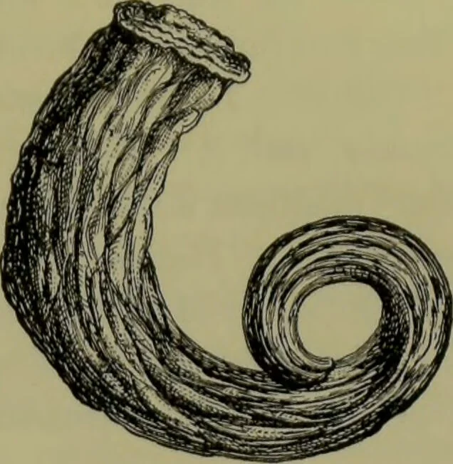 An illustration from Anomalies and curiosities of medicine : being an encyclopedic collection of rare and extraordinary cases, and of the most striking instances of abnormality in all branches of medicine and surgery, derived from an exhaustive research of medical literature from its origin to the present day / abstracted, classified, annotated, and indexed, by George M. Gould and Walter L. Pyle ; with 295 illustrations in the text, and 12 half-tone and colored plates., 1897, leaf 235