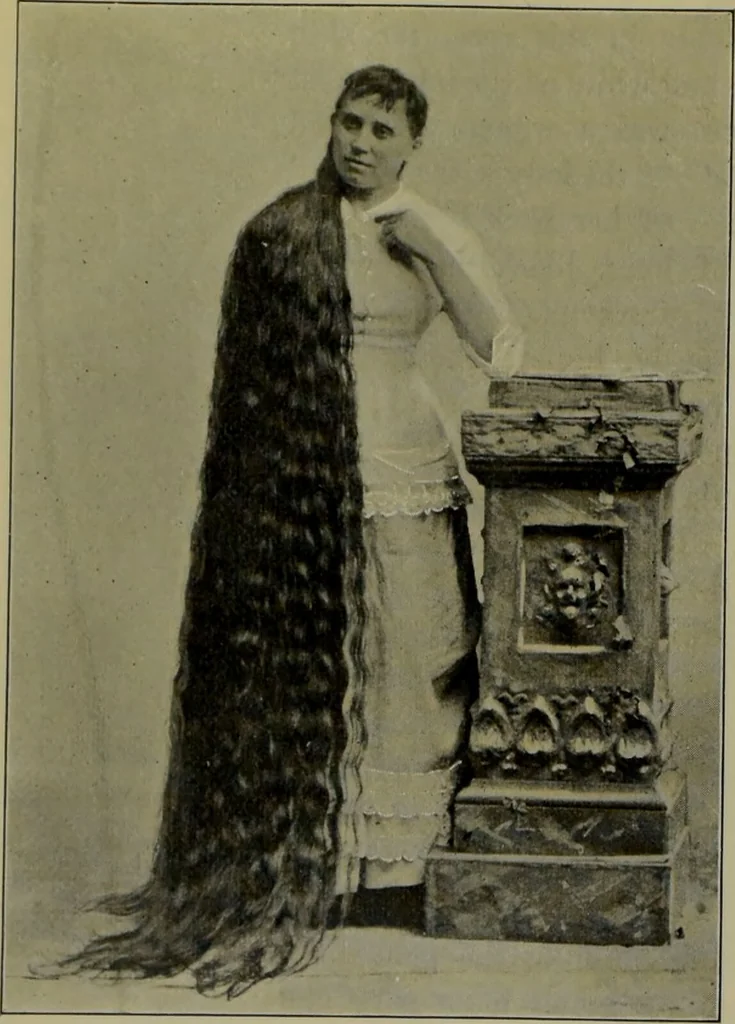 An illustration from Anomalies and curiosities of medicine : being an encyclopedic collection of rare and extraordinary cases, and of the most striking instances of abnormality in all branches of medicine and surgery, derived from an exhaustive research of medical literature from its origin to the present day / abstracted, classified, annotated, and indexed, by George M. Gould and Walter L. Pyle ; with 295 illustrations in the text, and 12 half-tone and colored plates., 1897, leaf 244