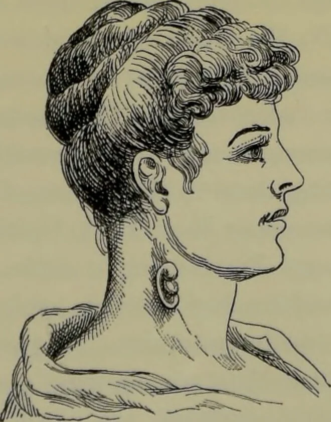 An illustration from Anomalies and curiosities of medicine : being an encyclopedic collection of rare and extraordinary cases, and of the most striking instances of abnormality in all branches of medicine and surgery, derived from an exhaustive research of medical literature from its origin to the present day / abstracted, classified, annotated, and indexed, by George M. Gould and Walter L. Pyle ; with 295 illustrations in the text, and 12 half-tone and colored plates., 1897, leaf 272