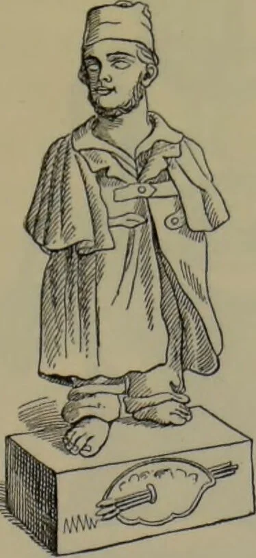 An illustration from Anomalies and curiosities of medicine : being an encyclopedic collection of rare and extraordinary cases, and of the most striking instances of abnormality in all branches of medicine and surgery, derived from an exhaustive research of medical literature from its origin to the present day / abstracted, classified, annotated, and indexed, by George M. Gould and Walter L. Pyle ; with 295 illustrations in the text, and 12 half-tone and colored plates., 1897, leaf 275