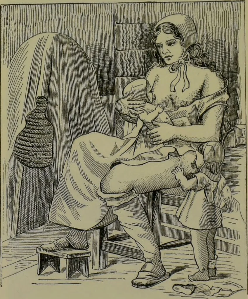 An illustration from Anomalies and curiosities of medicine : being an encyclopedic collection of rare and extraordinary cases, and of the most striking instances of abnormality in all branches of medicine and surgery, derived from an exhaustive research of medical literature from its origin to the present day / abstracted, classified, annotated, and indexed, by George M. Gould and Walter L. Pyle ; with 295 illustrations in the text, and 12 half-tone and colored plates., 1897, leaf 311