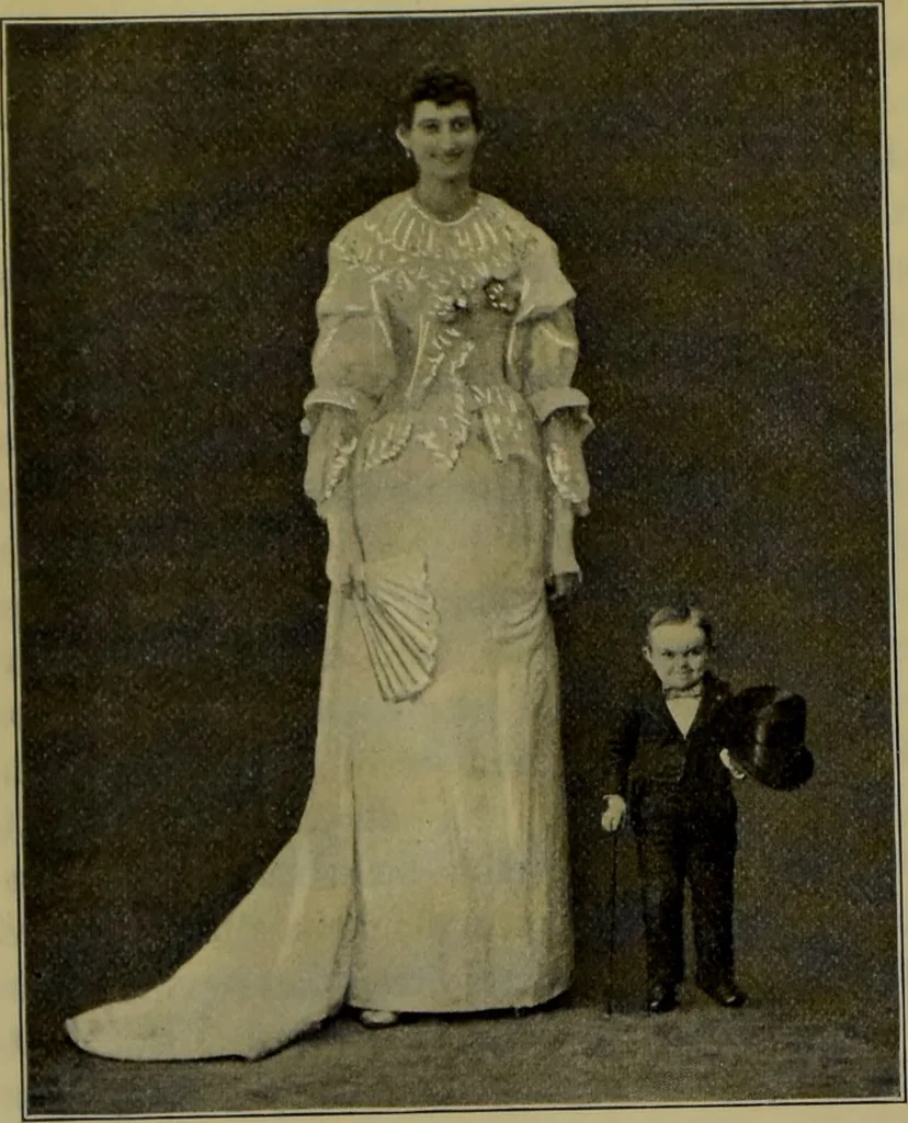 An illustration from Anomalies and curiosities of medicine : being an encyclopedic collection of rare and extraordinary cases, and of the most striking instances of abnormality in all branches of medicine and surgery, derived from an exhaustive research of medical literature from its origin to the present day / abstracted, classified, annotated, and indexed, by George M. Gould and Walter L. Pyle ; with 295 illustrations in the text, and 12 half-tone and colored plates., 1897, leaf 340