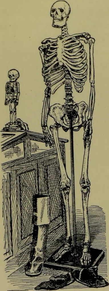 An illustration from Anomalies and curiosities of medicine : being an encyclopedic collection of rare and extraordinary cases, and of the most striking instances of abnormality in all branches of medicine and surgery, derived from an exhaustive research of medical literature from its origin to the present day / abstracted, classified, annotated, and indexed, by George M. Gould and Walter L. Pyle ; with 295 illustrations in the text, and 12 half-tone and colored plates., 1897, leaf 342