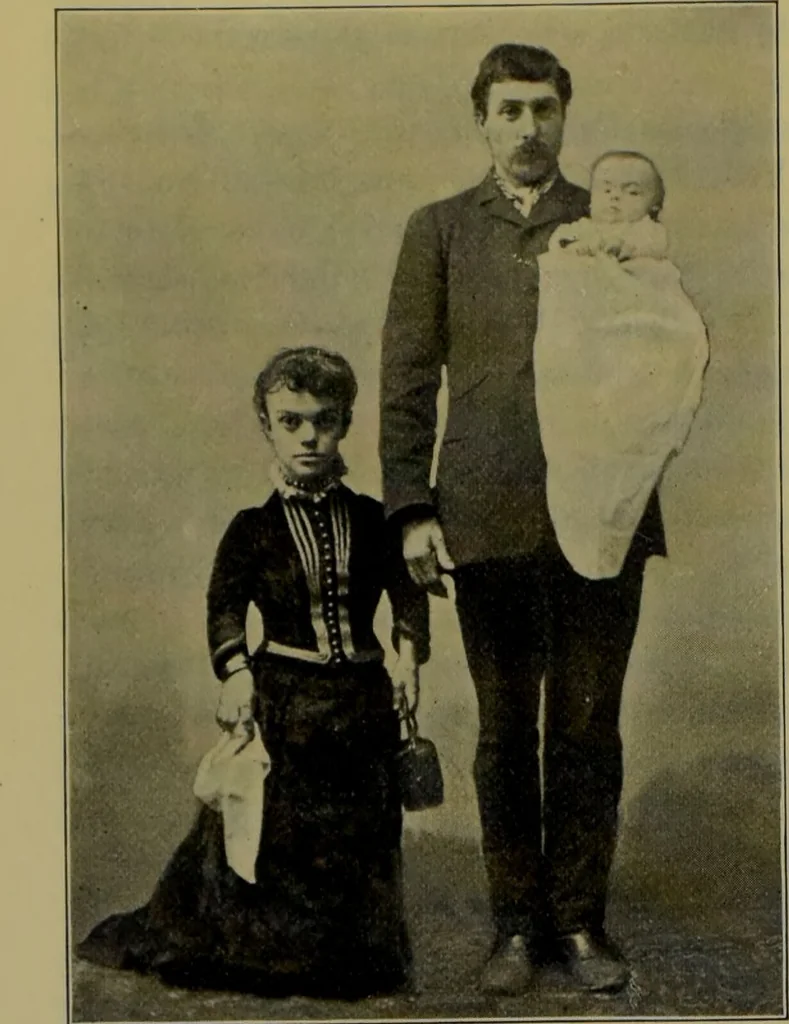 An illustration from Anomalies and curiosities of medicine : being an encyclopedic collection of rare and extraordinary cases, and of the most striking instances of abnormality in all branches of medicine and surgery, derived from an exhaustive research of medical literature from its origin to the present day / abstracted, classified, annotated, and indexed, by George M. Gould and Walter L. Pyle ; with 295 illustrations in the text, and 12 half-tone and colored plates., 1897, leaf 352