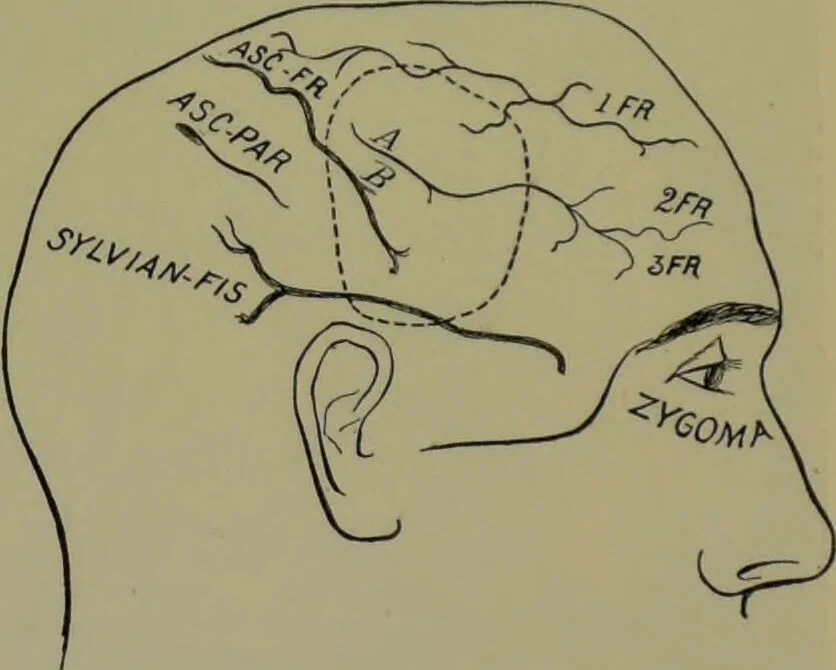 An illustration from Anomalies and curiosities of medicine : being an encyclopedic collection of rare and extraordinary cases, and of the most striking instances of abnormality in all branches of medicine and surgery, derived from an exhaustive research of medical literature from its origin to the present day / abstracted, classified, annotated, and indexed, by George M. Gould and Walter L. Pyle ; with 295 illustrations in the text, and 12 half-tone and colored plates., 1897, leaf 569