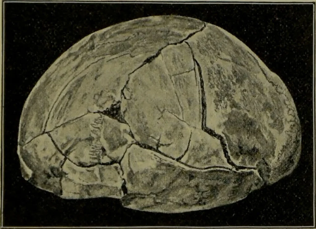 An illustration from Anomalies and curiosities of medicine : being an encyclopedic collection of rare and extraordinary cases, and of the most striking instances of abnormality in all branches of medicine and surgery, derived from an exhaustive research of medical literature from its origin to the present day / abstracted, classified, annotated, and indexed, by George M. Gould and Walter L. Pyle ; with 295 illustrations in the text, and 12 half-tone and colored plates., 1897, leaf 570
