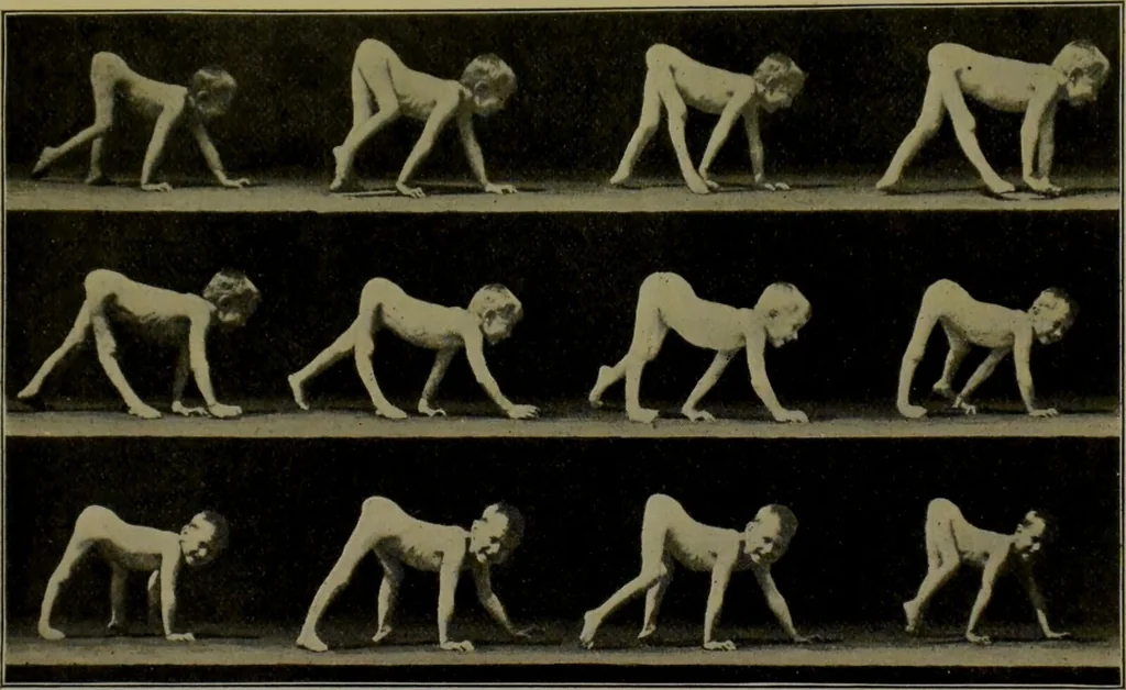 An illustration from Anomalies and curiosities of medicine : being an encyclopedic collection of rare and extraordinary cases, and of the most striking instances of abnormality in all branches of medicine and surgery, derived from an exhaustive research of medical literature from its origin to the present day / abstracted, classified, annotated, and indexed, by George M. Gould and Walter L. Pyle ; with 295 illustrations in the text, and 12 half-tone and colored plates., 1897, leaf 617