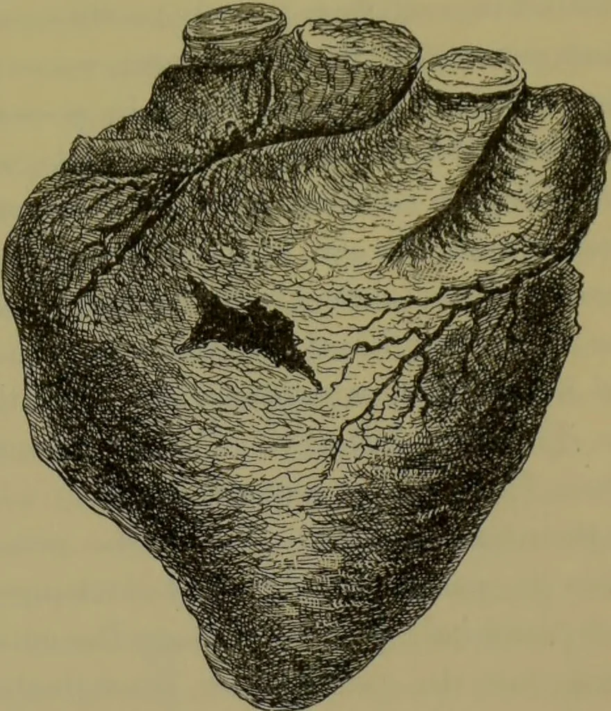 An illustration from Anomalies and curiosities of medicine : being an encyclopedic collection of rare and extraordinary cases, and of the most striking instances of abnormality in all branches of medicine and surgery, derived from an exhaustive research of medical literature from its origin to the present day / abstracted, classified, annotated, and indexed, by George M. Gould and Walter L. Pyle ; with 295 illustrations in the text, and 12 half-tone and colored plates., 1897, leaf 631