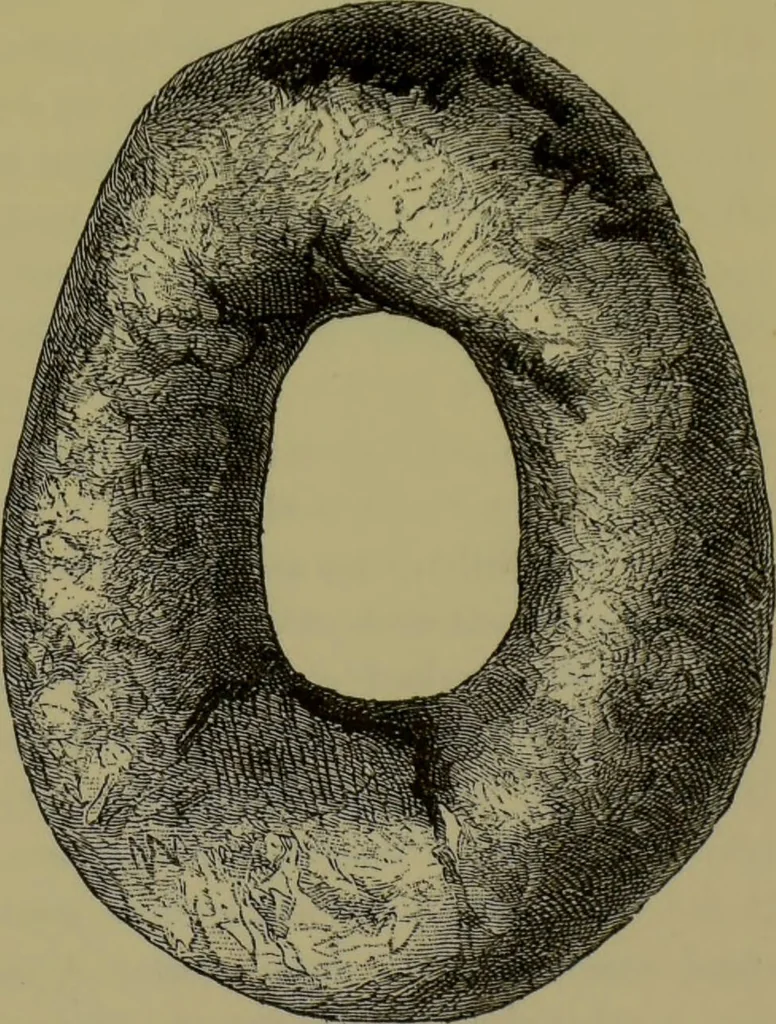 An illustration from Anomalies and curiosities of medicine : being an encyclopedic collection of rare and extraordinary cases, and of the most striking instances of abnormality in all branches of medicine and surgery, derived from an exhaustive research of medical literature from its origin to the present day / abstracted, classified, annotated, and indexed, by George M. Gould and Walter L. Pyle ; with 295 illustrations in the text, and 12 half-tone and colored plates., 1897, leaf 705