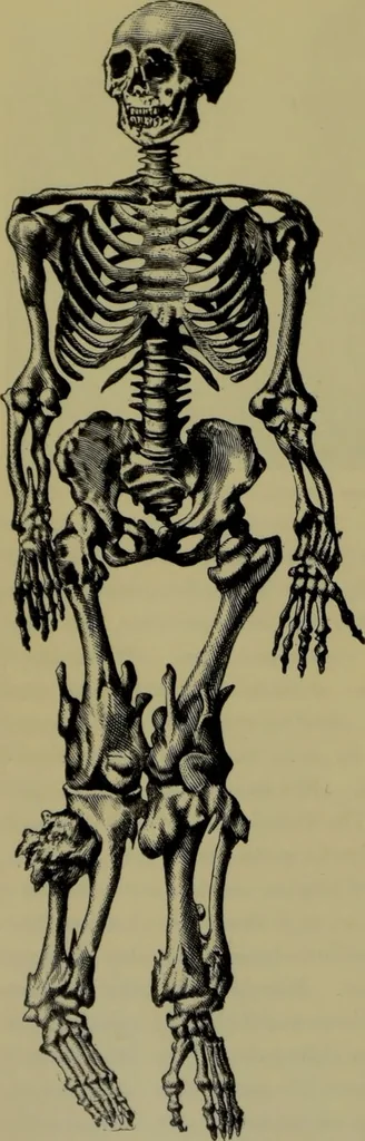 An illustration from Anomalies and curiosities of medicine : being an encyclopedic collection of rare and extraordinary cases, and of the most striking instances of abnormality in all branches of medicine and surgery, derived from an exhaustive research of medical literature from its origin to the present day / abstracted, classified, annotated, and indexed, by George M. Gould and Walter L. Pyle ; with 295 illustrations in the text, and 12 half-tone and colored plates., 1897, leaf 780