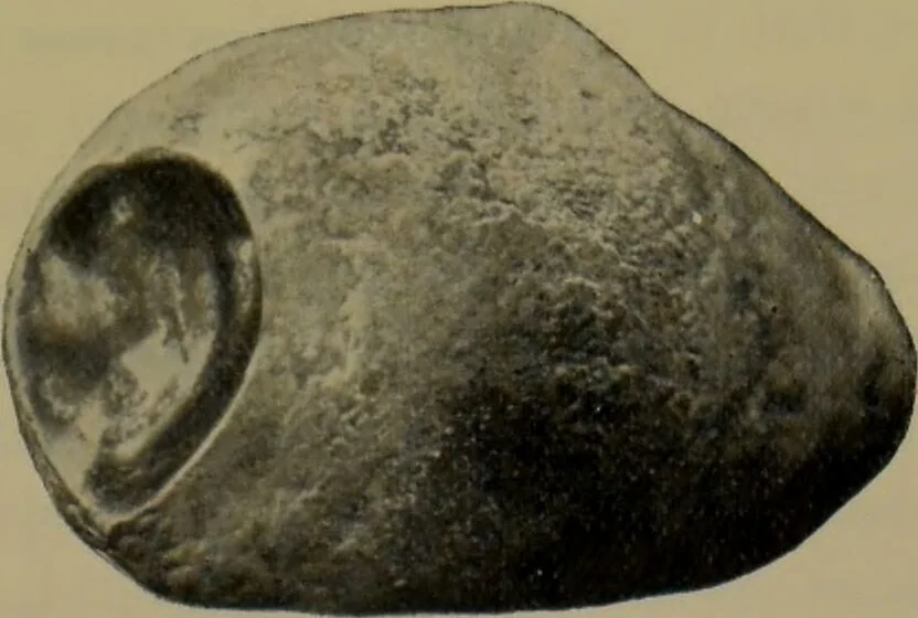 An illustration from Anomalies and curiosities of medicine : being an encyclopedic collection of rare and extraordinary cases, and of the most striking instances of abnormality in all branches of medicine and surgery, derived from an exhaustive research of medical literature from its origin to the present day / abstracted, classified, annotated, and indexed, by George M. Gould and Walter L. Pyle ; with 295 illustrations in the text, and 12 half-tone and colored plates., 1897, leaf 803