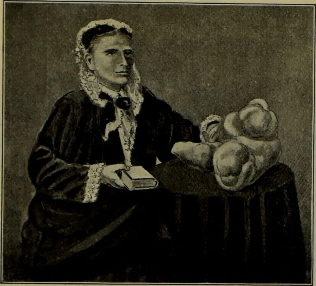 An illustration from Anomalies and curiosities of medicine : being an encyclopedic collection of rare and extraordinary cases, and of the most striking instances of abnormality in all branches of medicine and surgery, derived from an exhaustive research of medical literature from its origin to the present day / abstracted, classified, annotated, and indexed, by George M. Gould and Walter L. Pyle ; with 295 illustrations in the text, and 12 half-tone and colored plates., 1897, leaf 810