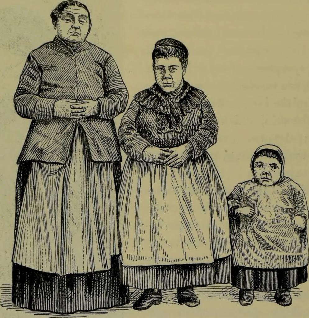 An illustration from Anomalies and curiosities of medicine : being an encyclopedic collection of rare and extraordinary cases, and of the most striking instances of abnormality in all branches of medicine and surgery, derived from an exhaustive research of medical literature from its origin to the present day / abstracted, classified, annotated, and indexed, by George M. Gould and Walter L. Pyle ; with 295 illustrations in the text, and 12 half-tone and colored plates., 1897, leaf 820