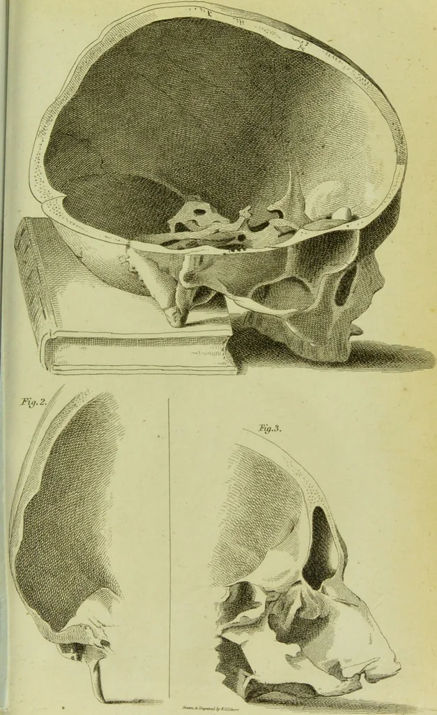 An illustration from Illustrations of phrenology : with engravings / by Sir G. S. Mackenzie., 1820, leaf 295
